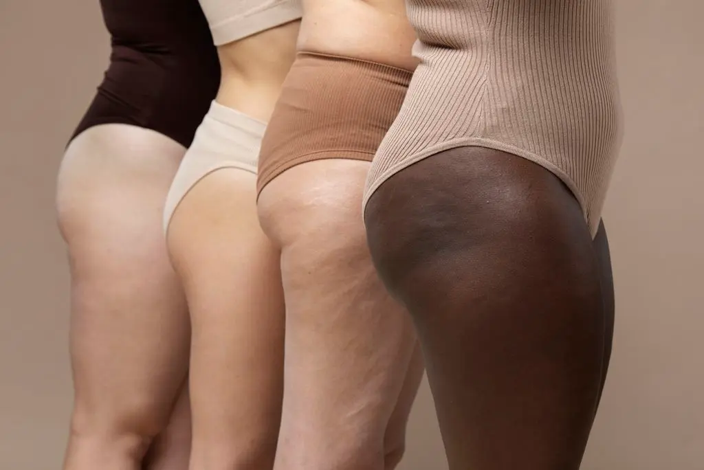 Direito à Cirurgia de Lipedema pelo Plano e SUS - Image by Freepik.com